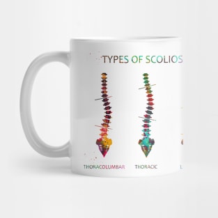Type of scoliosis of spine Mug